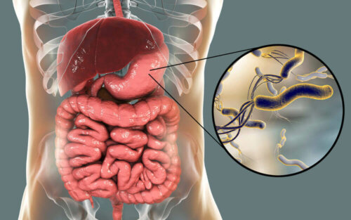 A diagram of the bacteria that cause bloating and diarrhea.