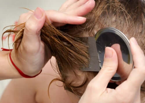 Seven Natural Ways to Get Rid of Lice and Nits