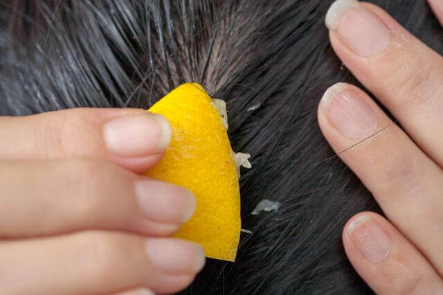 Image result for hair fall control lemon