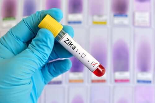 Warning! 10 Things You Should Know about Zika Virus