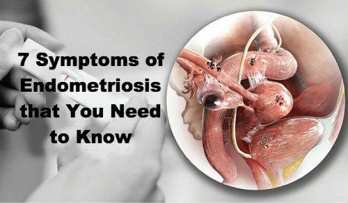 6 Endometriosis Symptoms that You Need to Know
