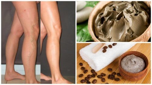 Five Natural Ways to Fight Varicose Veins