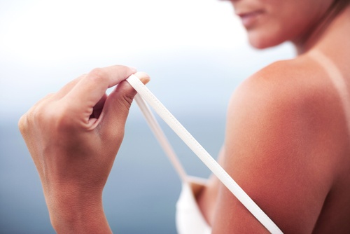 Sunburnt shoulder