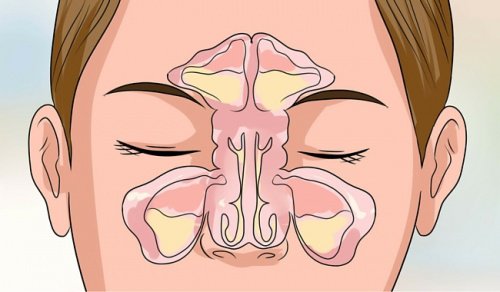 6 Tips to Get Relief From a Stuffy Nose