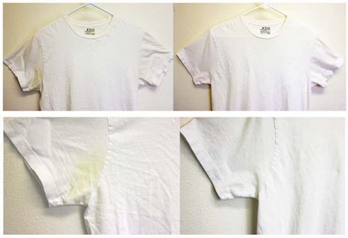 https://steptohealth.com/wp-content/uploads/2016/08/1-yellow-stains.jpg