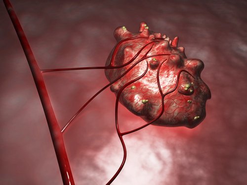 An ovary with cysts