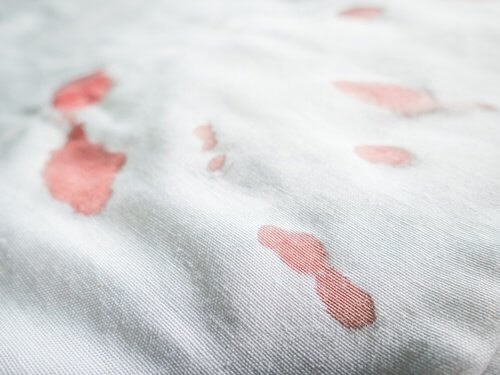 Bloodstains on white clothes