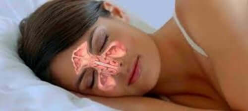 A woman sleeping with clear sinuses.