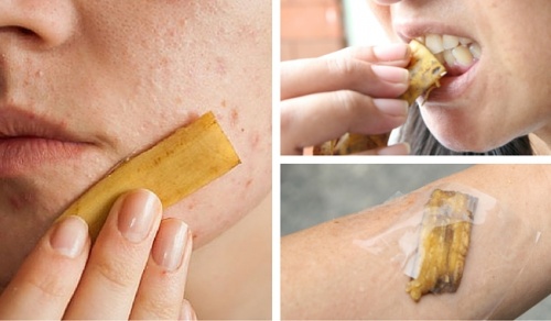 11 Ways to Use Banana Peels: Stop Wasting Them!