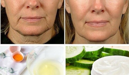 5 Home Remedies to Fight Facial Sagging