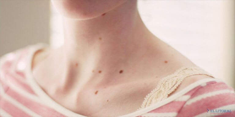 A lot of Red Spots on Skin: Should You Be Worried? - Step To Health