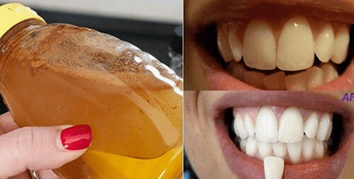 Whiten Your Teeth with a 100% Natural Ingredient