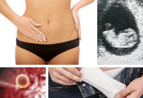 Why Did I Get Two Menstrual Periods in One Month?