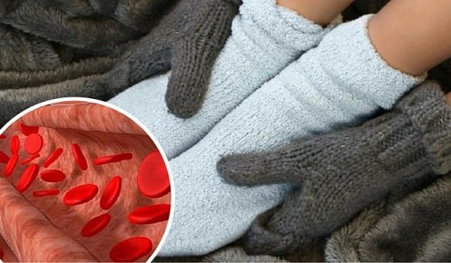 Remedies to Improve Circulation and Relieve Inflammation