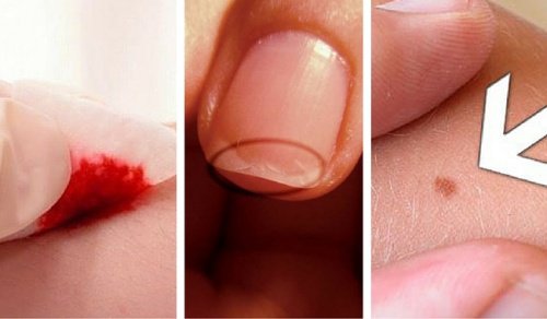 5 Reasons to not Skip Your Dermatologist Visit