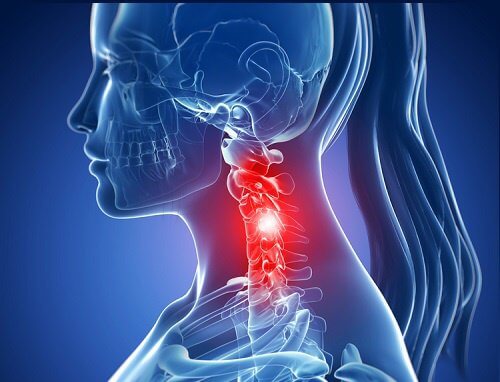 Six Exercises that May Help Relieve Neck Pain