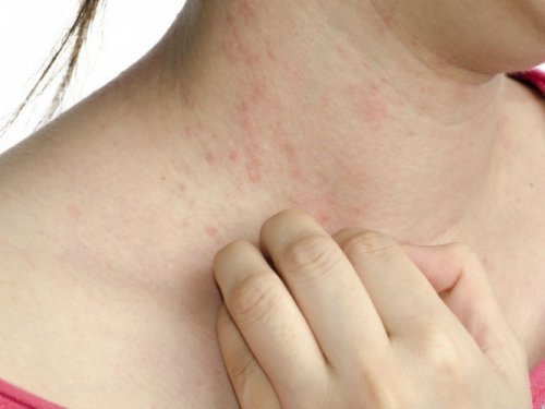 5 Little-Known Symptoms of Diabetes
