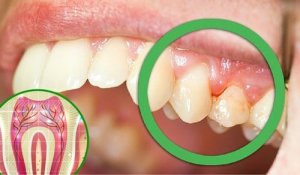 6 Reasons Why You Could Be Experiencing Tooth Pain