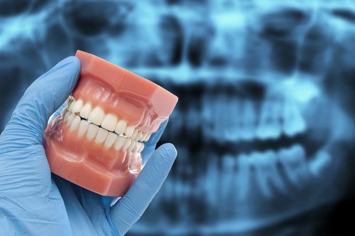 Dentchers