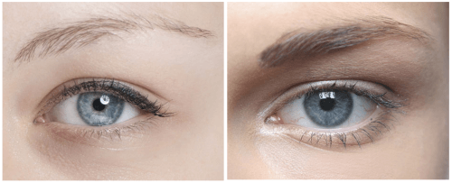 Thin Eyebrows: How to Deal With Them in a Natural Way