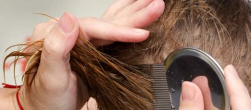 7 Natural Ways to Get Rid of Head Lice
