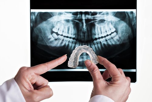Bruxism treatment