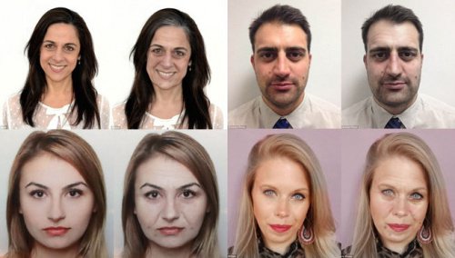 10 Negative Effects of Stress on Your Appearance
