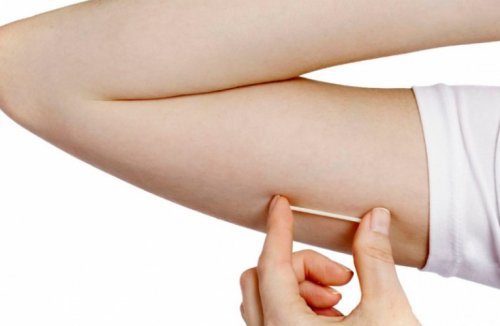 Subdermal Contraceptive Implants: An Overview