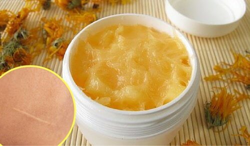A Natural Cream to Heal Cuts and Scars