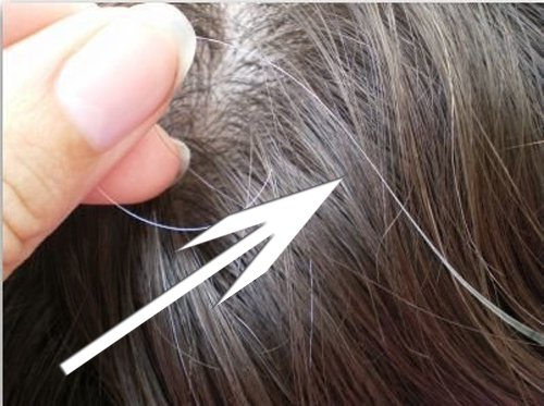 gray hair
