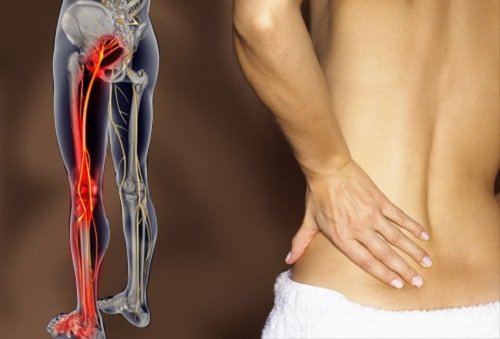 Person with back pain