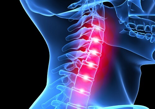X ray of neck and vertebra