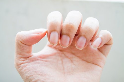 Hand with bitten nails