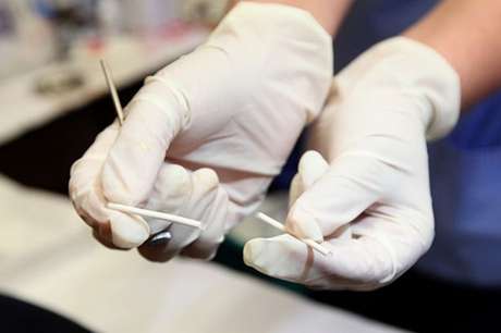 Subdermal contraceptive implants