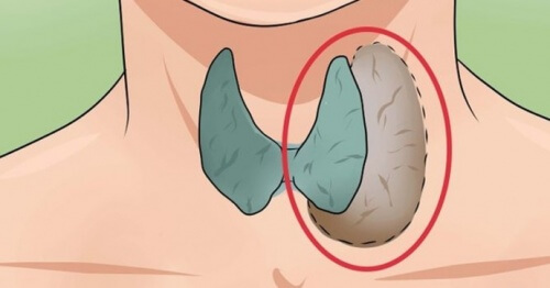 14 Signs and Symptoms of Thyroid Problems