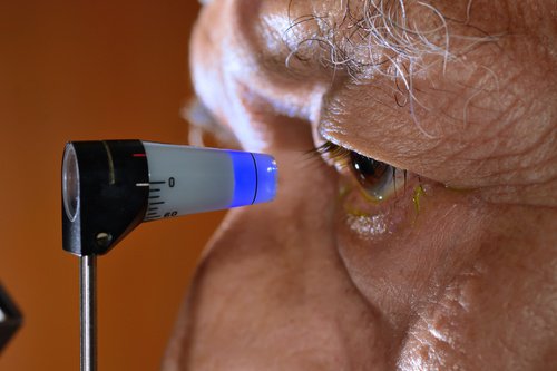 Natural Ways to Prevent Glaucoma
