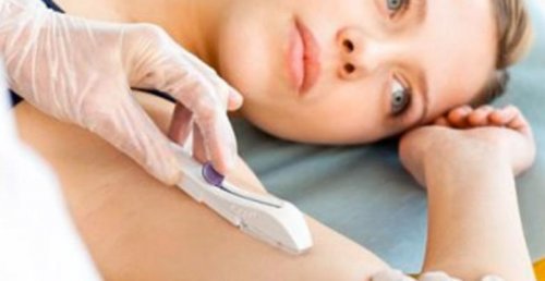 Woman subdermal contraceptive applicator