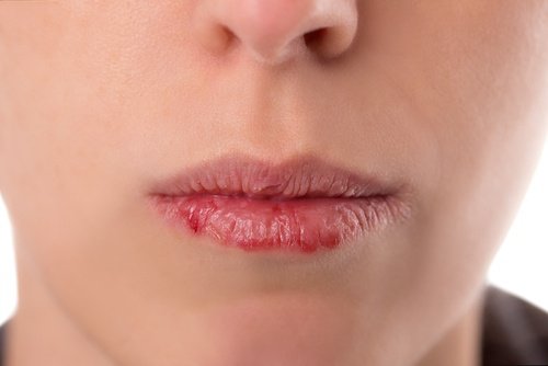 Oropharyngeal Cancer Symptoms You Need To Know
