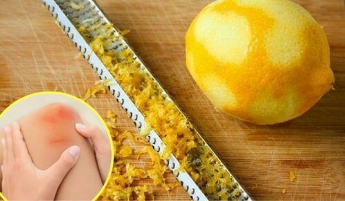 How To Use Lemon Peel for Joint Pain