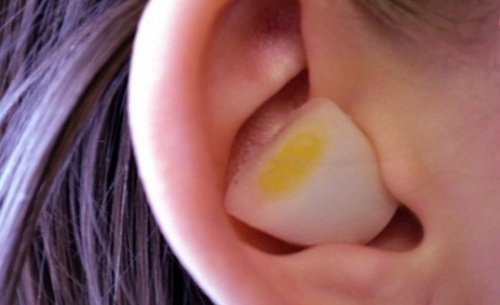 Ear with a white and yellow object inside