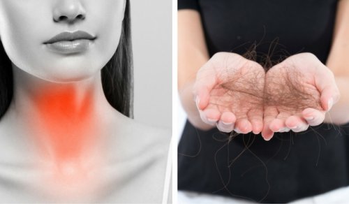 8 Things to Fight Thyroid-Related Hair Loss