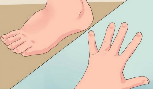 5 Simple Ways to Decrease Water Retention