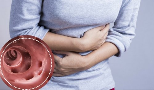Diverticulitis kan ook een oorzaak zijn van buikpijn