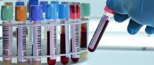 A Blood Test to Diagnose Depression