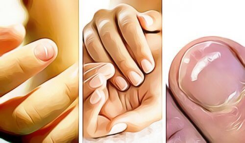 Five Ways Your Fingernails Show You Something's Wrong With Your Health