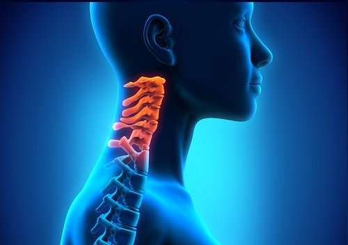 Spondylosis affects the vertebrae of the neck.