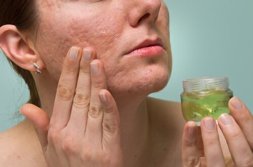 Woman rubbing aloe gel onto face