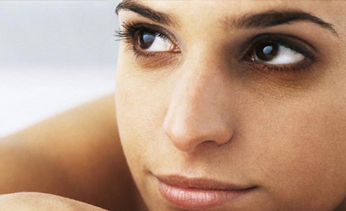 Woman with dark circles under her eyes