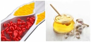 A Remedy to Reduce Cholesterol and Relieve Joint Pain