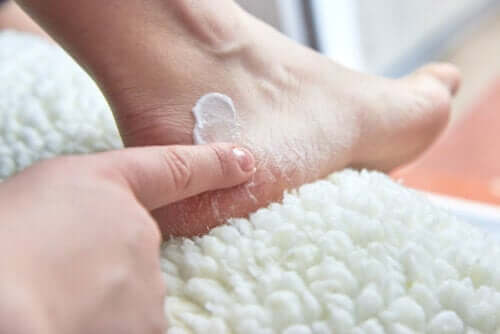 Six Ways to Treat Dry And Cracked Heels